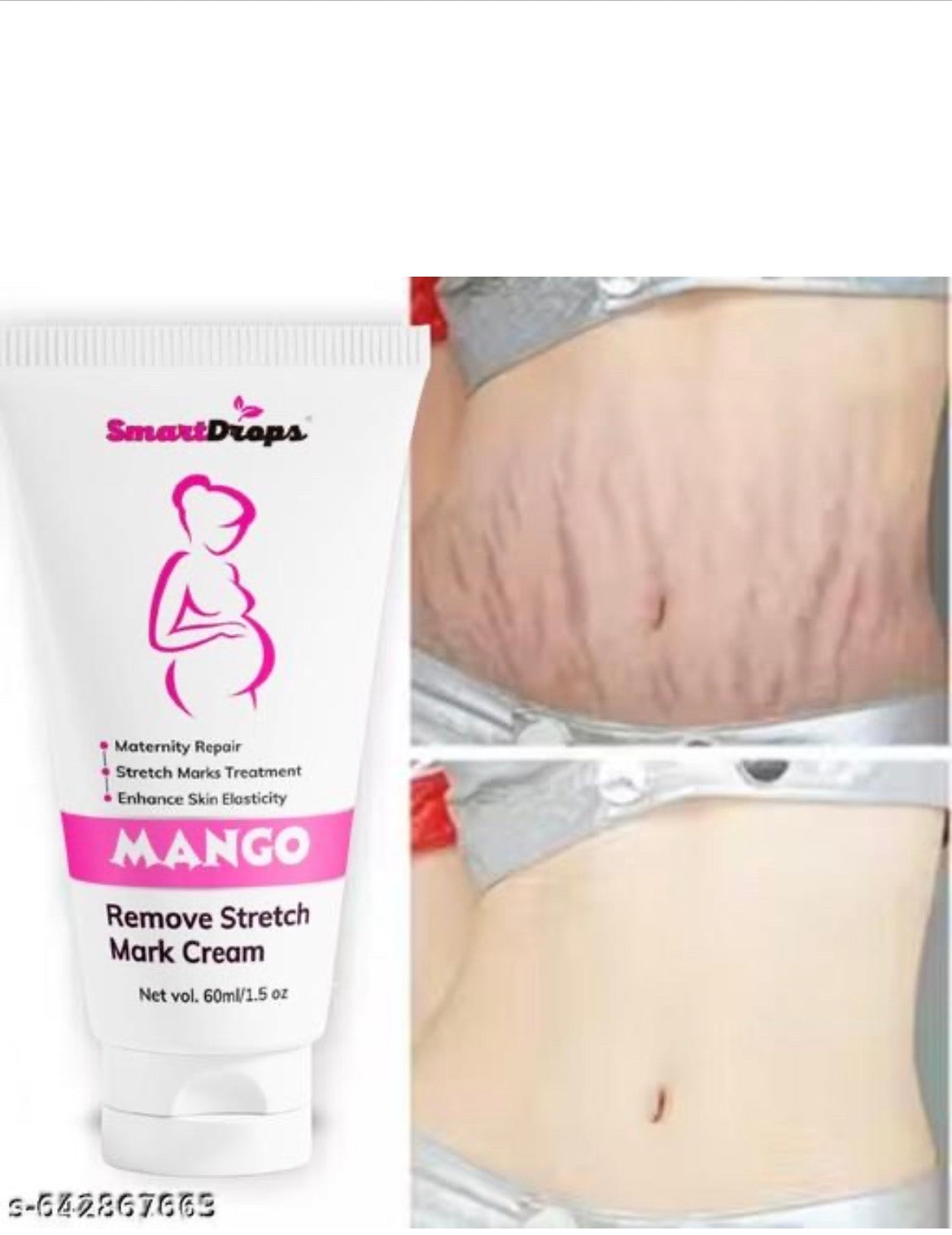 Stretch marks removal cream, stretch marks and scars creams...