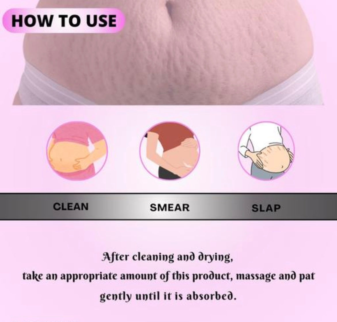 Stretch marks removal cream, stretch marks and scars creams...